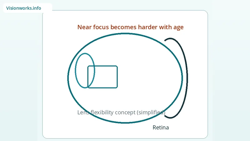 Simplified educational focusing diagram for Presbyopia